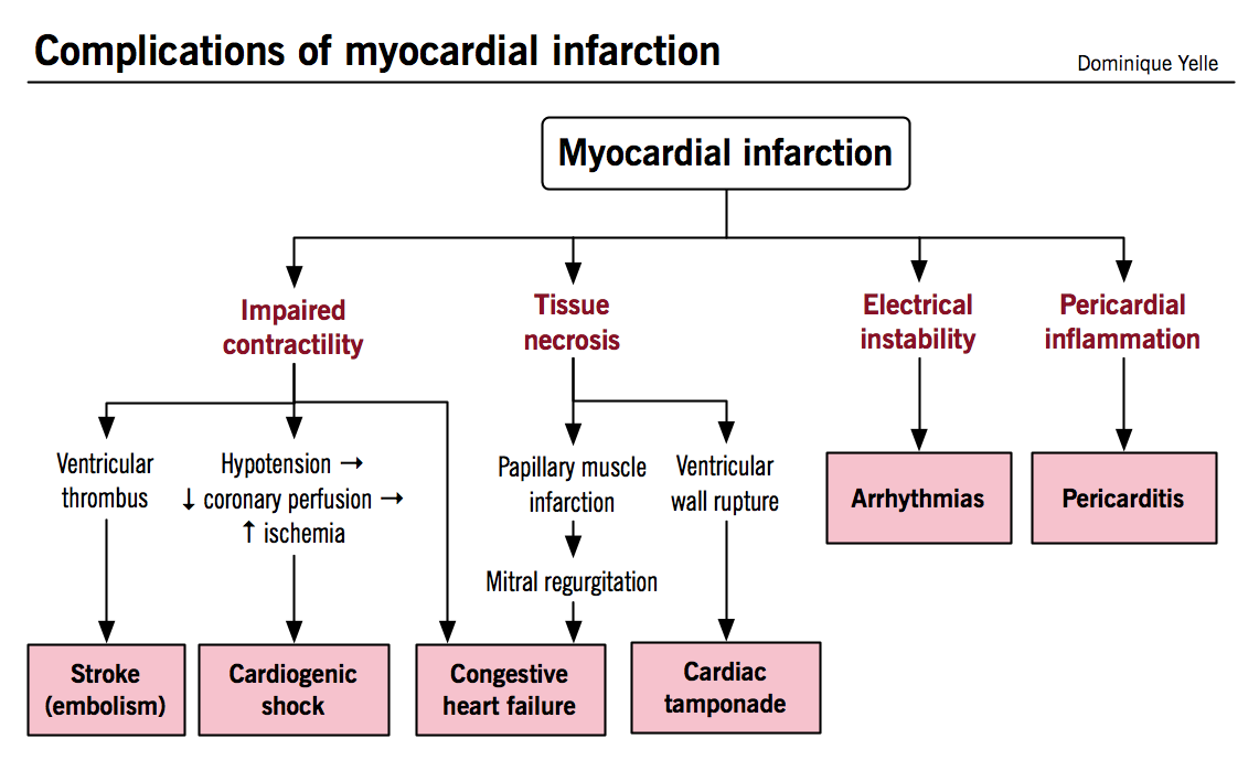 Patho of myocardial infarction