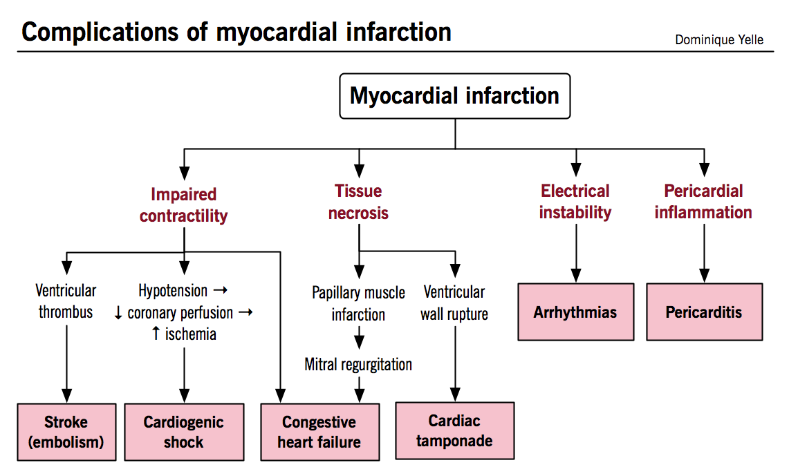 Pathophysiology Of Coronary Heart Disease In Flow Chart