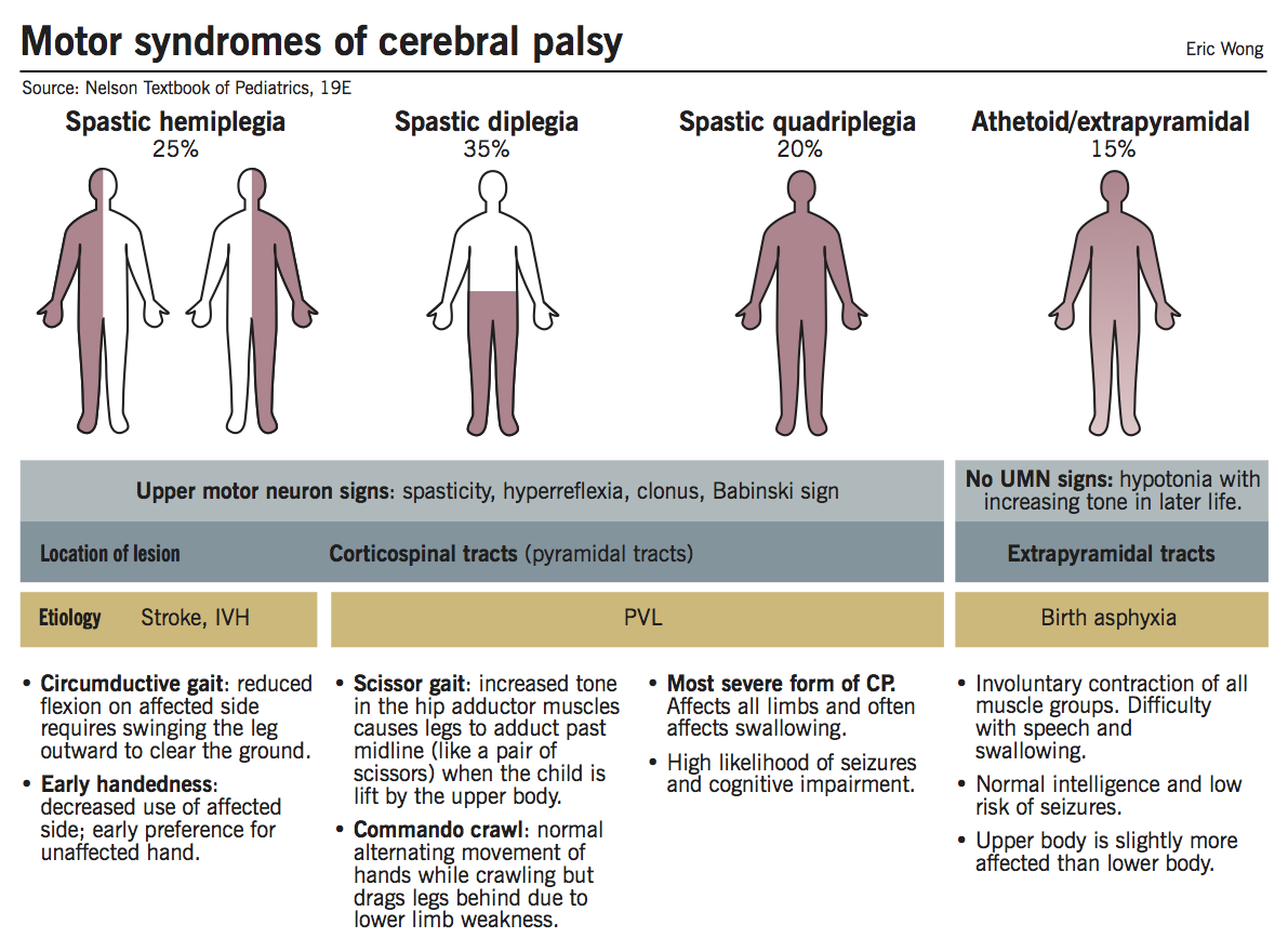 cerebral palsy | mcmaster pathophysiology review