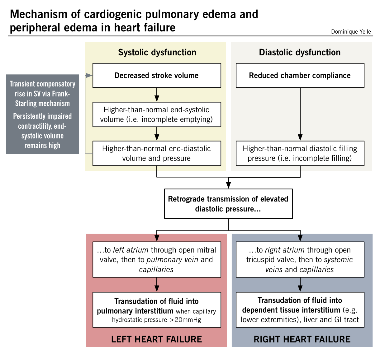 Mechanism of cardiogenic pulmonary edema and peripheral edema in heart failure